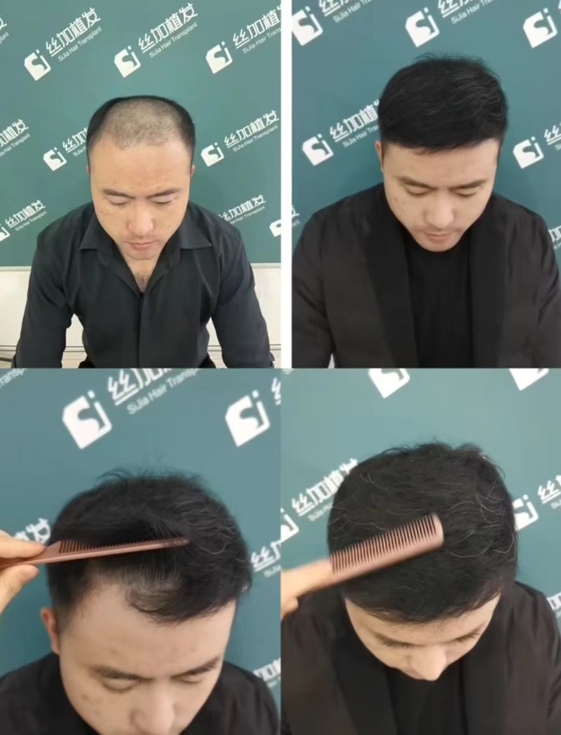 ��ʰ��������׃���󡪡�ֲ�l(f��)�g(sh��)������������